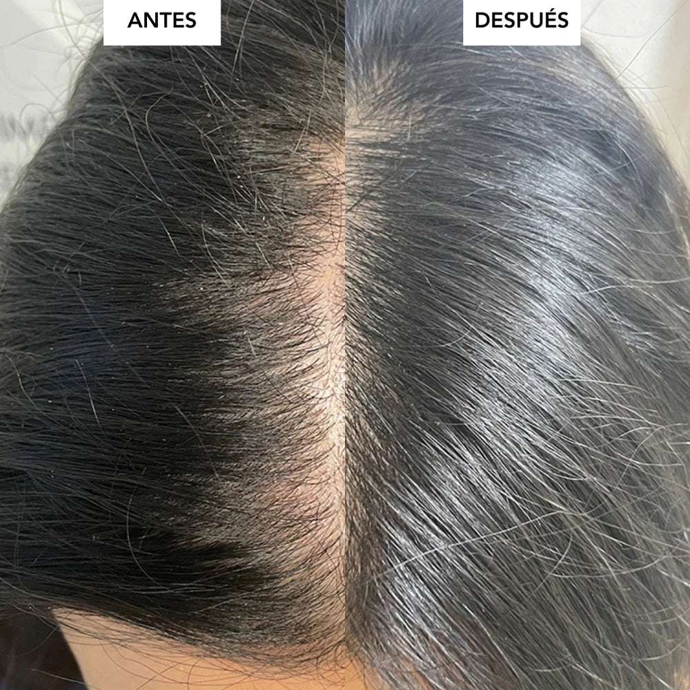 Novazoma | Rejuvenece tu Pelo