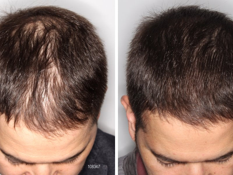 Novazoma | Rejuvenece tu Pelo